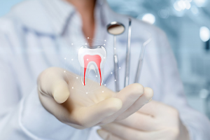Essential Tips to Prepare for Your Root Canal Treatment